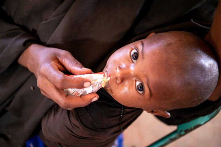 Podhranjen otrok v Dolowu v Somaliji, med zdravniškim pregledom, 3. februarja 2022.