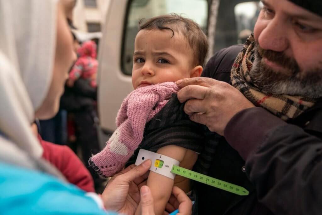 koraj 3-letni Sondos med pregledom za ugotavljanje podhranjenosti, ki ga izvajajo mobilne ekipe na terenu v Alepu, katerih delovanje podpira UNICEF.