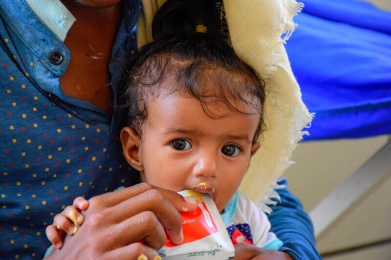 7-mesečni Ebtihal iz Jemna med hranjenjem s terapevtsko hrano, ki jo za podhranjene otroke zagotavlja UNICEF.