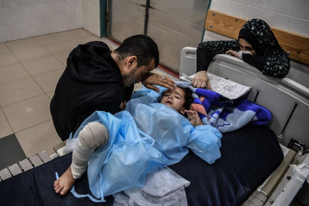4-letni deklici so v bolnišnici Nasser morali amputirati nogo, saj je bila poškodba, ki jo je utrpela v napadih, prehuda. V bolnišnici jo spremljajo mama, oče in babica.