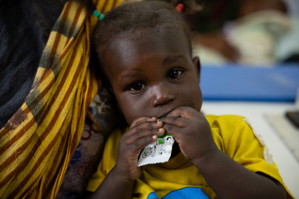 1-letni Goyum uživa terapevtsko hrano v centru primarnega zdravstvenega varstva Alenaz v zvezni državi Al Jazirah, Sudan.