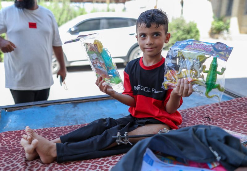 Mohammed, 10-letni deček, ki ima v nogi vstavljeno platino zaradi poškodb, ki jih je utrpel med vojno, prejema UNICEF-ov komplet psihosocialne pomoči (PSS komplet) na severu Gaze, zahvaljujoč podpori vlad Švice, Cipra in Švedske.