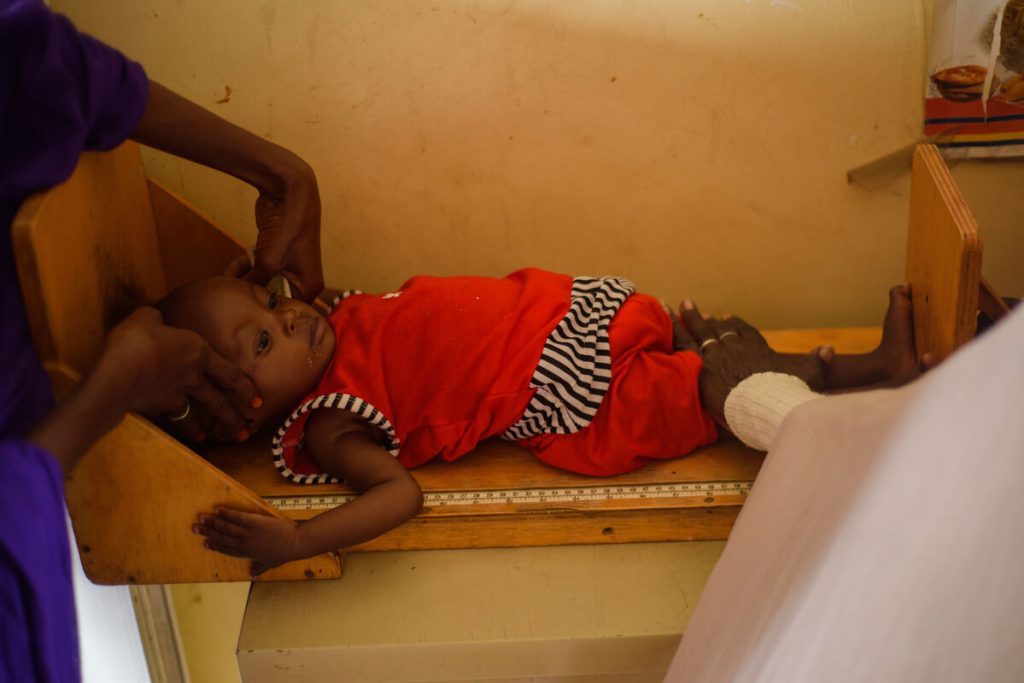 Podhranjena 1-letna Mawada med pregledom v zdravstvenem centru Dar Al-Salam v Port Sudanu.