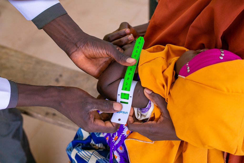 Zdravstveni delavec pregleduje dojenčka z merilnim trakom za odkrivanje podhranjenosti.