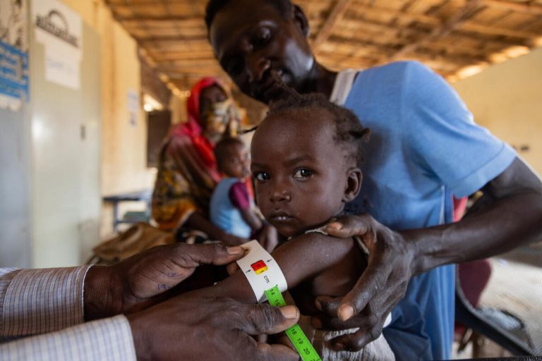 Deklici merijo obseg nadlakti za diagnisticiranje podhranjenosti v enem od UNICEF-ovih centrov za pomoč podhranjenim otrokom v Sudanu. Rdeča barva na traku označuje podhranjenost.
