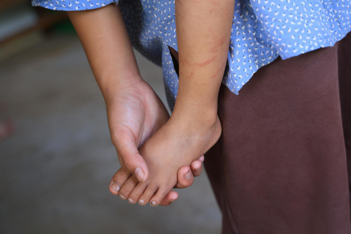 Sonika drži za nogo svojega mlajšega brata Sajana v šoli v okrožju Nuvakot, kjer družina prebiva odkar je 26. avgusta pobegnila pred poplavami, ki so uničile njihov dom in vas v Nepalu.