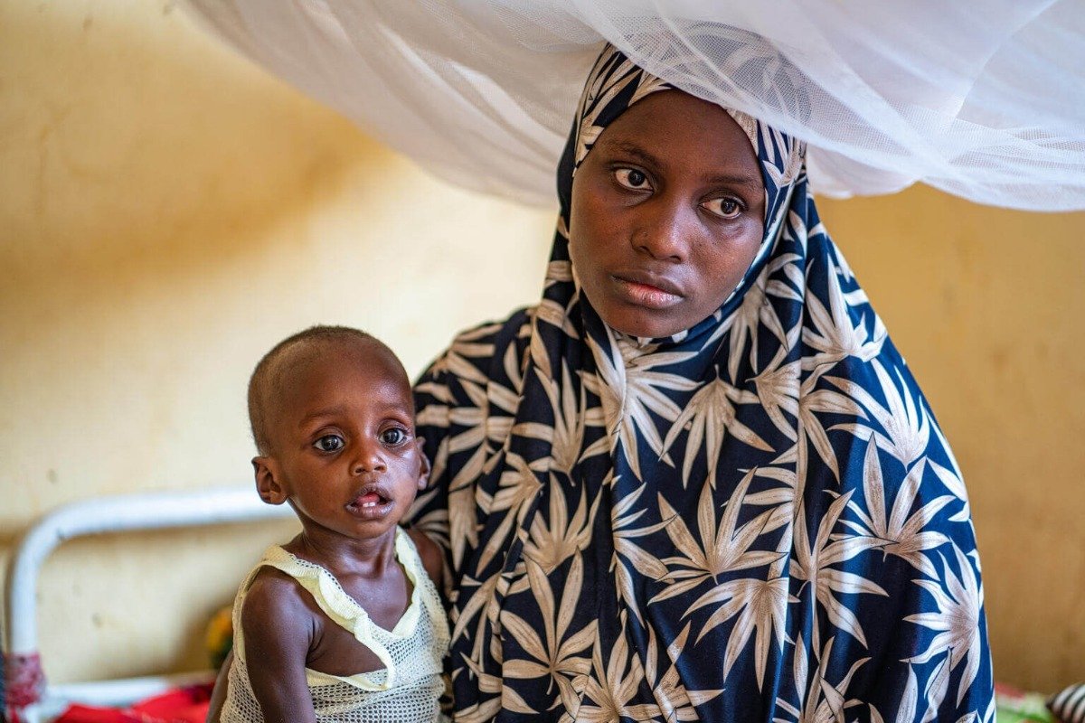 Mama, ki v naročju drži otroka, ki trpi zaradi hude podhranjenosti, v bolnišnici.