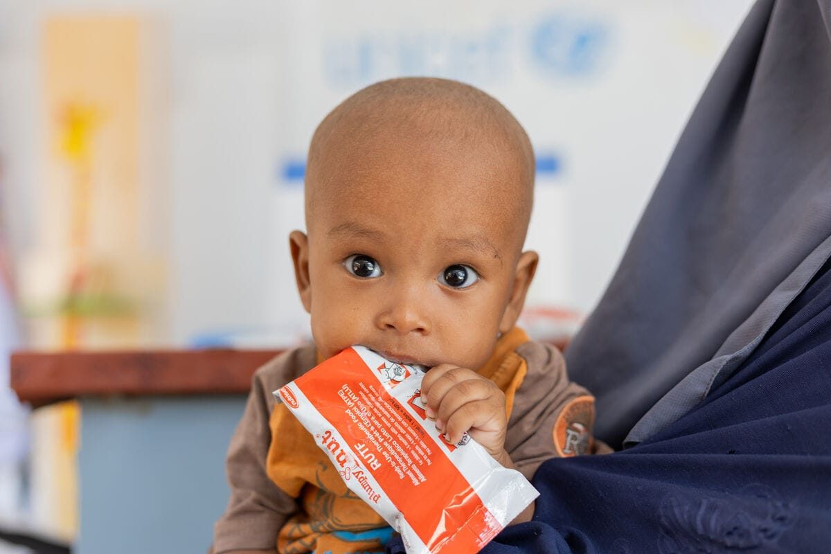 Deček iz Sudana je RUTF terapevtsko hrano.